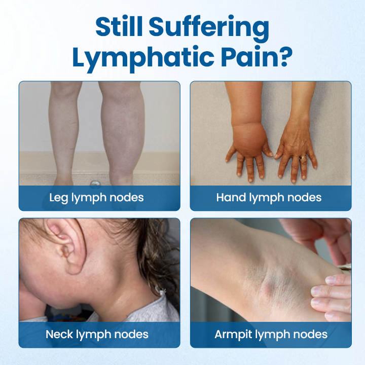 Mayo Clinic recommends👨⚕️: Lymphora Swelling Relief Roll-On