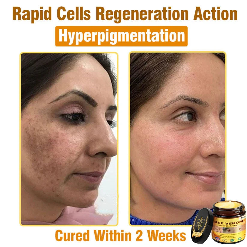 Bee Venom All-in-One Cream US Dermatologist Approved🐝