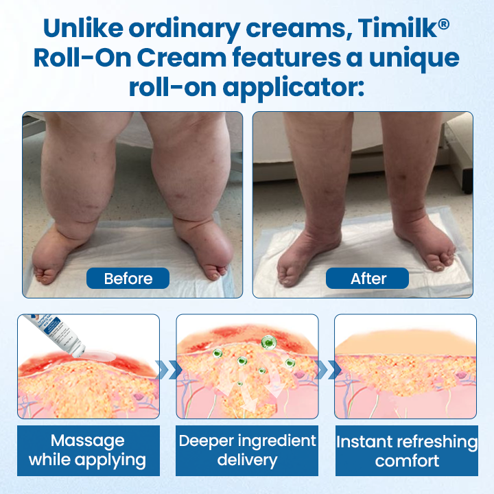 Mayo Clinic recommends👨⚕️: Lymphora Swelling Relief Roll-On