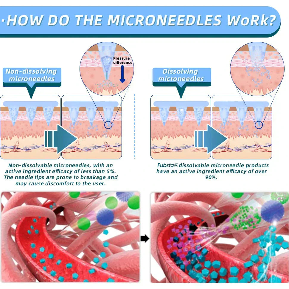 【Genuine Preferred🥇】NIDDK-Tirzepatide Nano Microneedle Patch 🇺🇸🧀(Zero Pain, 24/7 Release | Lose 20lbs FAST | 90% Sugar Drop | )