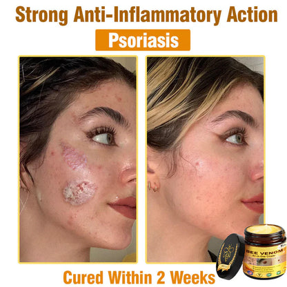 Bee Venom All-in-One Cream US Dermatologist Approved🐝