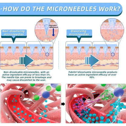 【Genuine Preferred🥇】NIDDK-Tirzepatide Nano Microneedle Patch 🇺🇸🧀（Zero Pain, 24/7 Release | Lose 20lbs FAST | 90% Sugar Drop | ）
